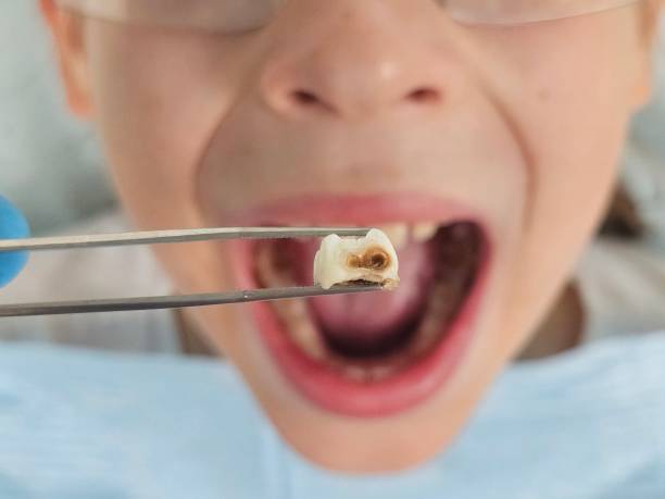 Best Emergency Treatment for Toothache in Whitestown, IN