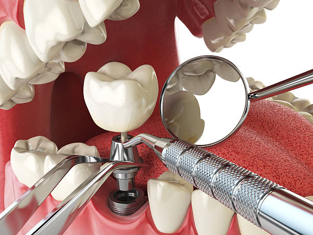 Best Same-Day Emergency Dentist in Whitestown, IN